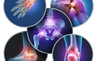Five Exercises to Improve Joint Health