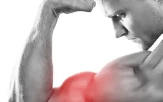 What is a Distal Biceps Rupture and How is it Fixed?